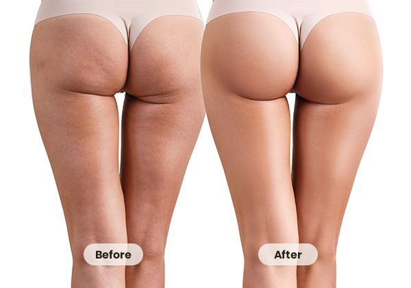 FIR Beauty Fabric function